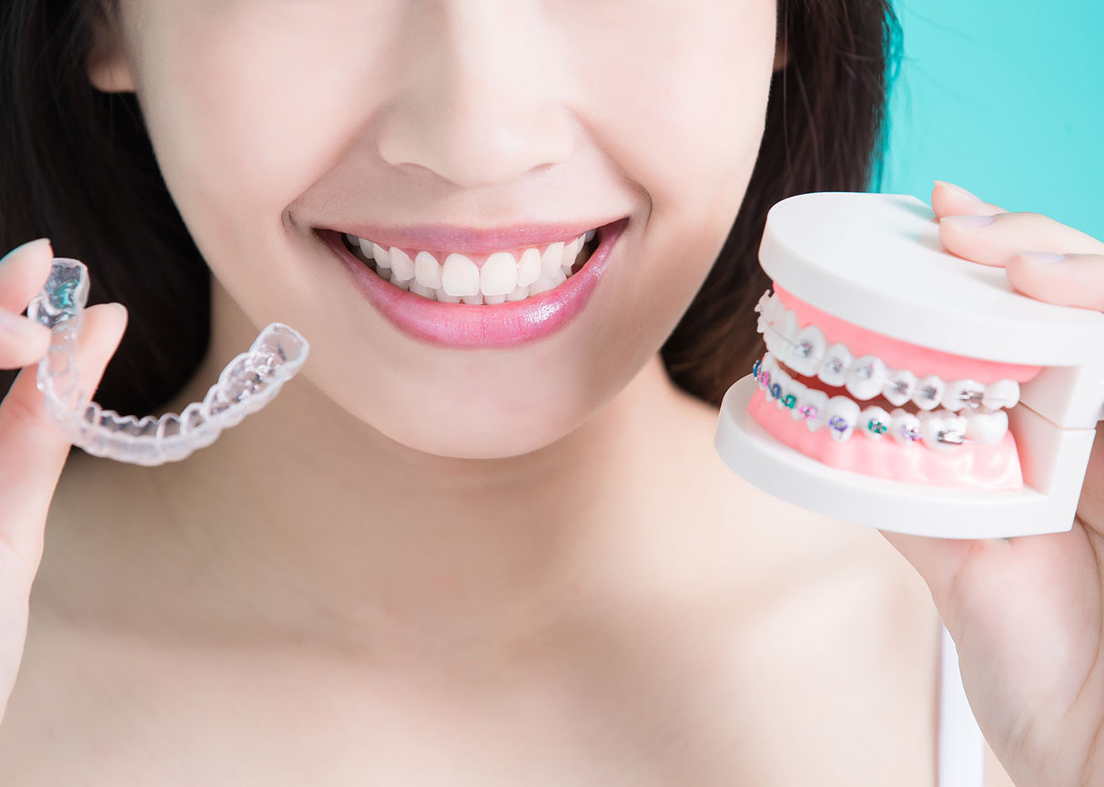 Terapia con allineatori
